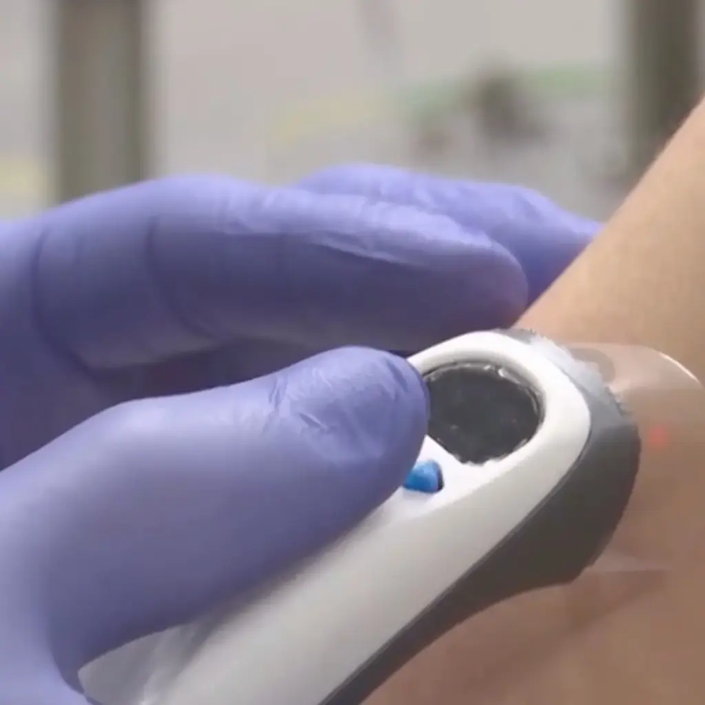 New Machines May Send Medical Nurses Home