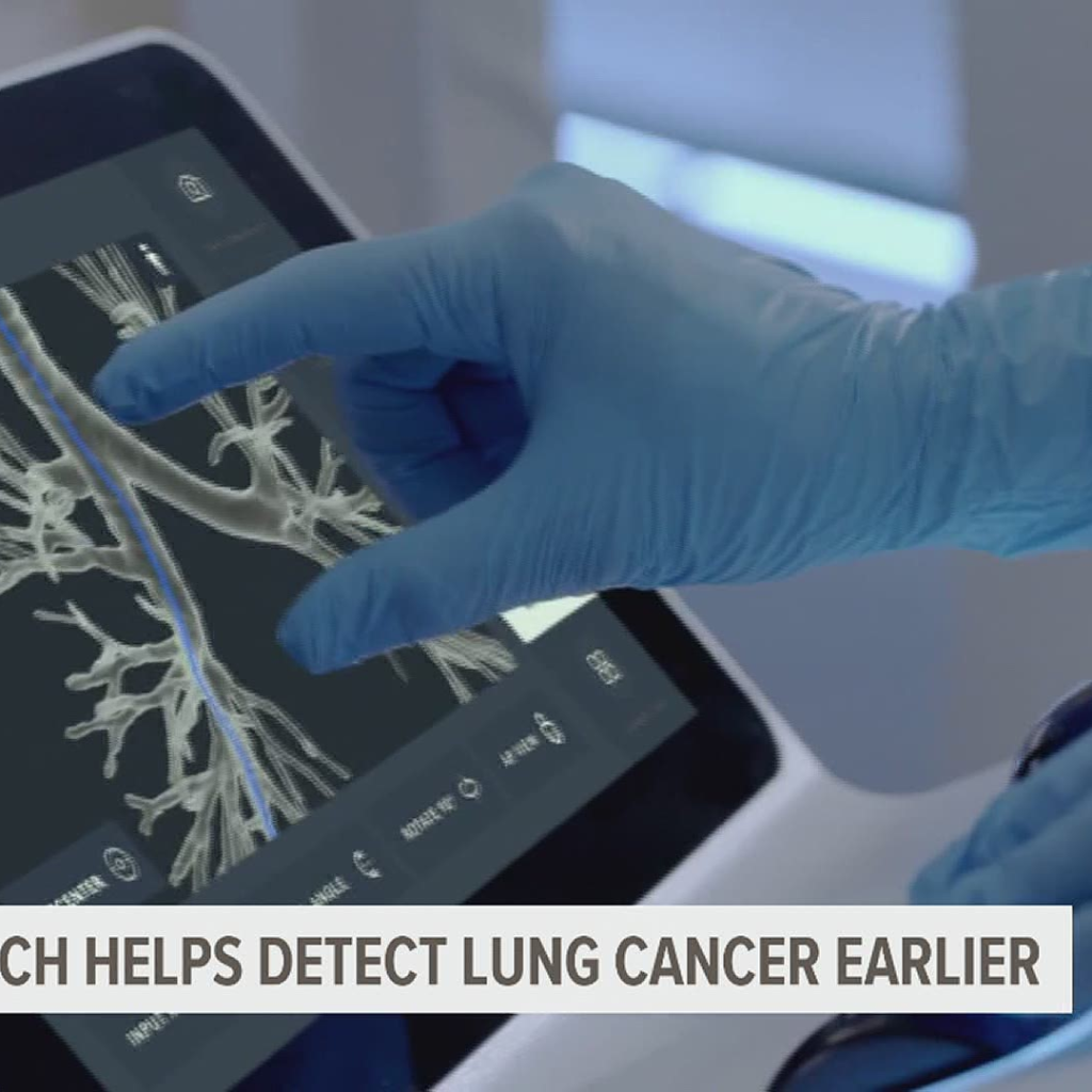 Robotic Technology That Can Discover Lung Cancer Early