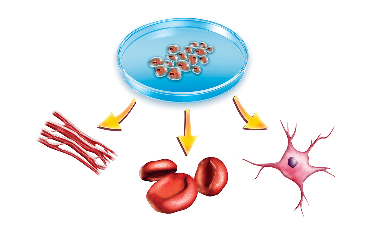 Patient-specific cells