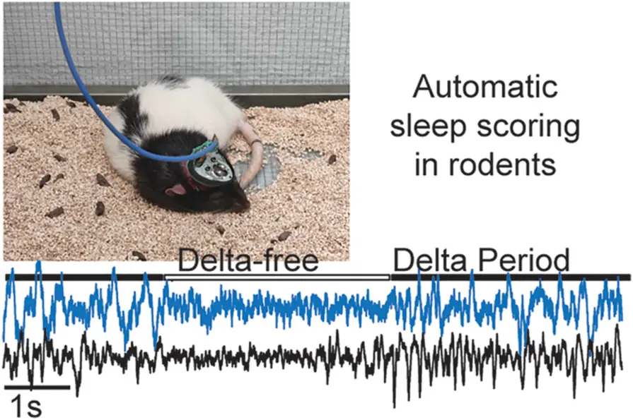 Sleeping promotes the Glymphatic clearance