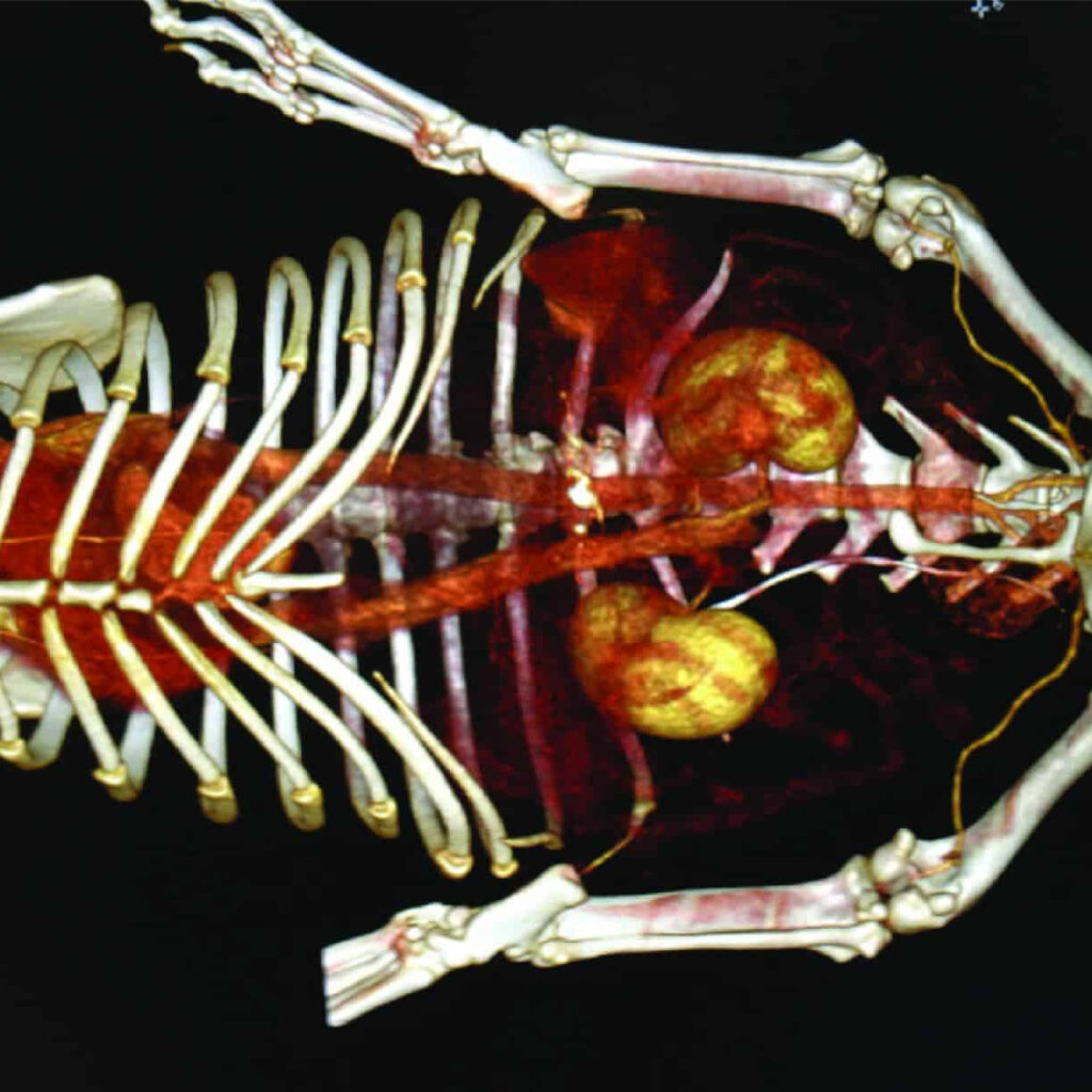 pet ct scan result