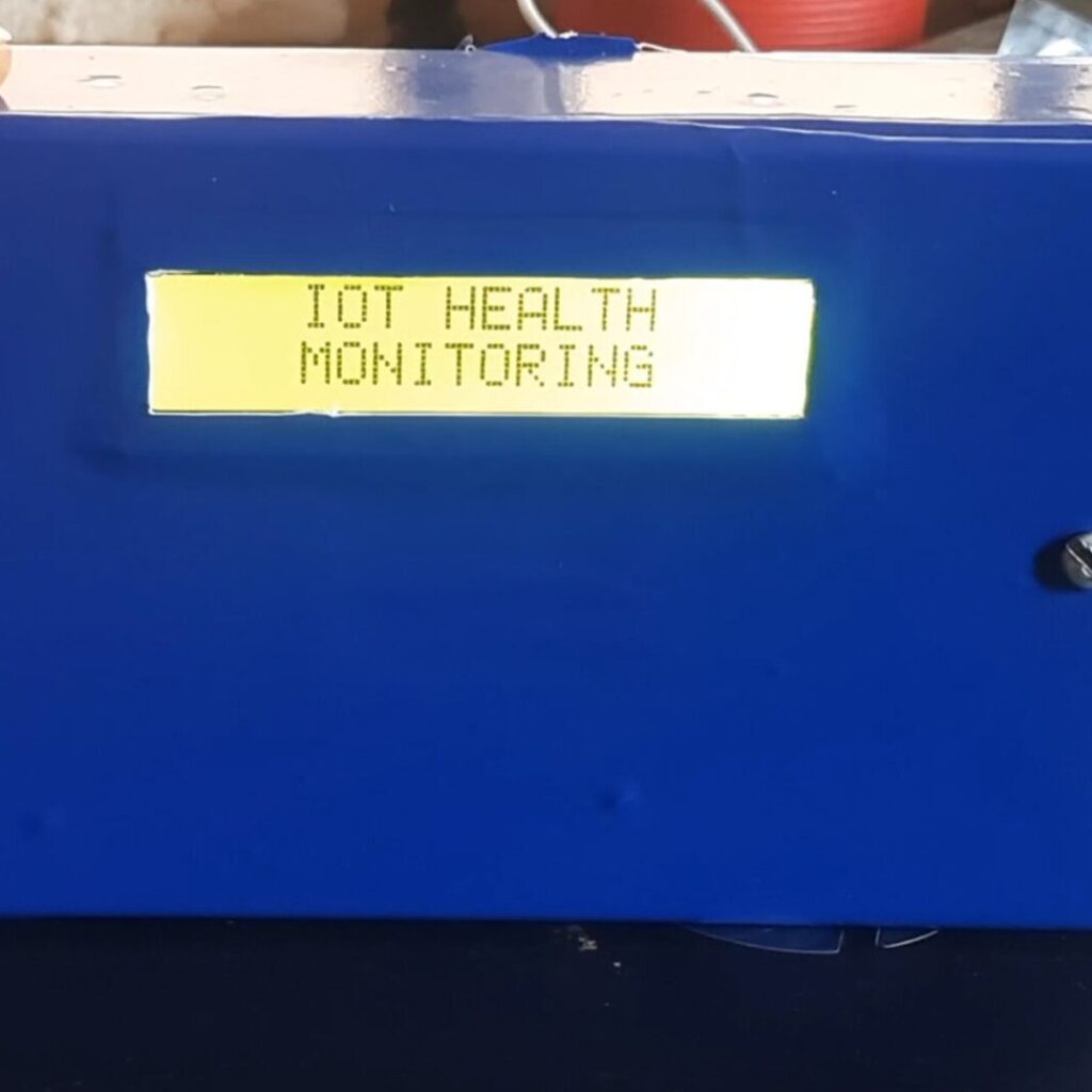 IoT based Health Monitoring System