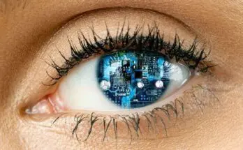 A bionic eye implant