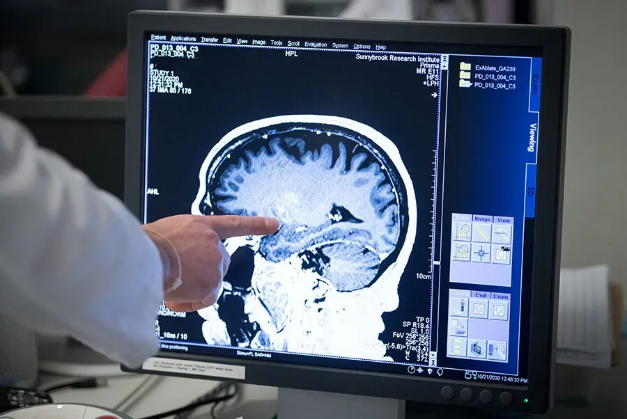 The Most Intriguing Neurological Conditions