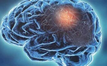 The Most Intriguing Neurological Conditions