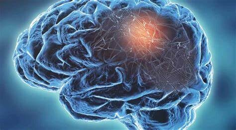 The Most Intriguing Neurological Conditions