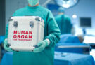 Exploring the Medical Consequences of Organ Donation Policies