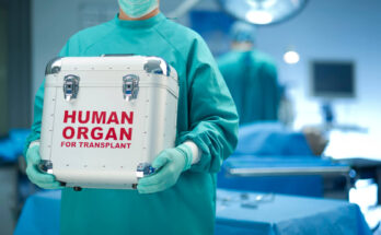 Exploring the Medical Consequences of Organ Donation Policies