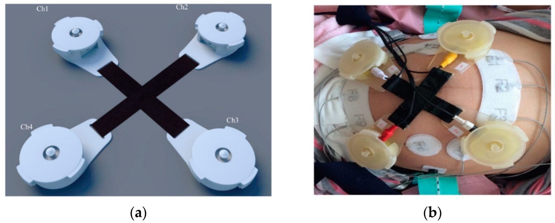 Non-Invasive Glucose and ECG levels Monitoring using Arduino: An ECG sensor for pregnancy