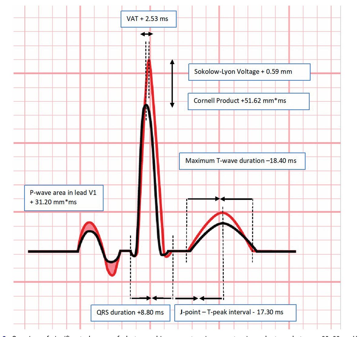 The Blood pressure chart