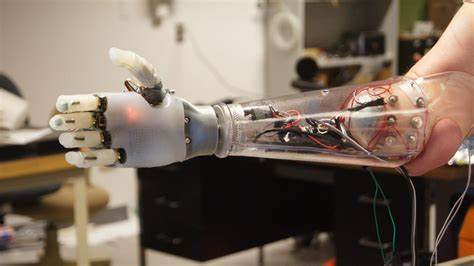 Prosthetic  Arm