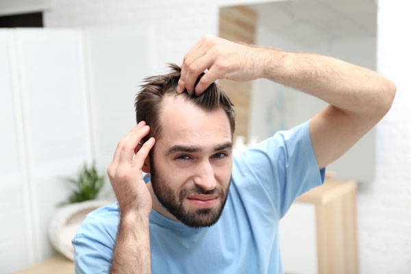 Receding Hairline 101: Causes, Solutions, and Tips for Prevention