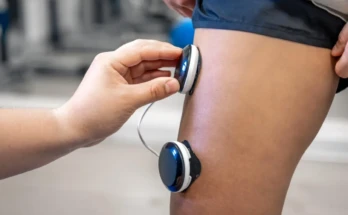 Wearable Tech for Chronic Pain management- a myostimulator for muscle pain
